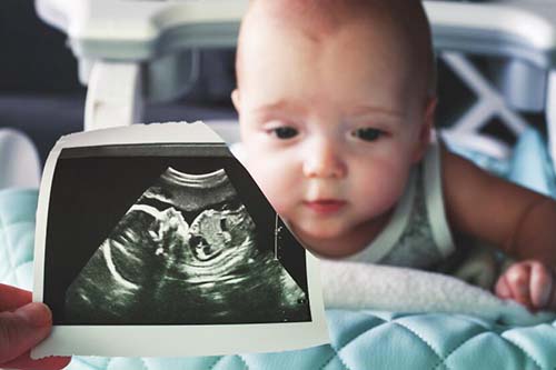试管婴儿：胚胎移植的小知识